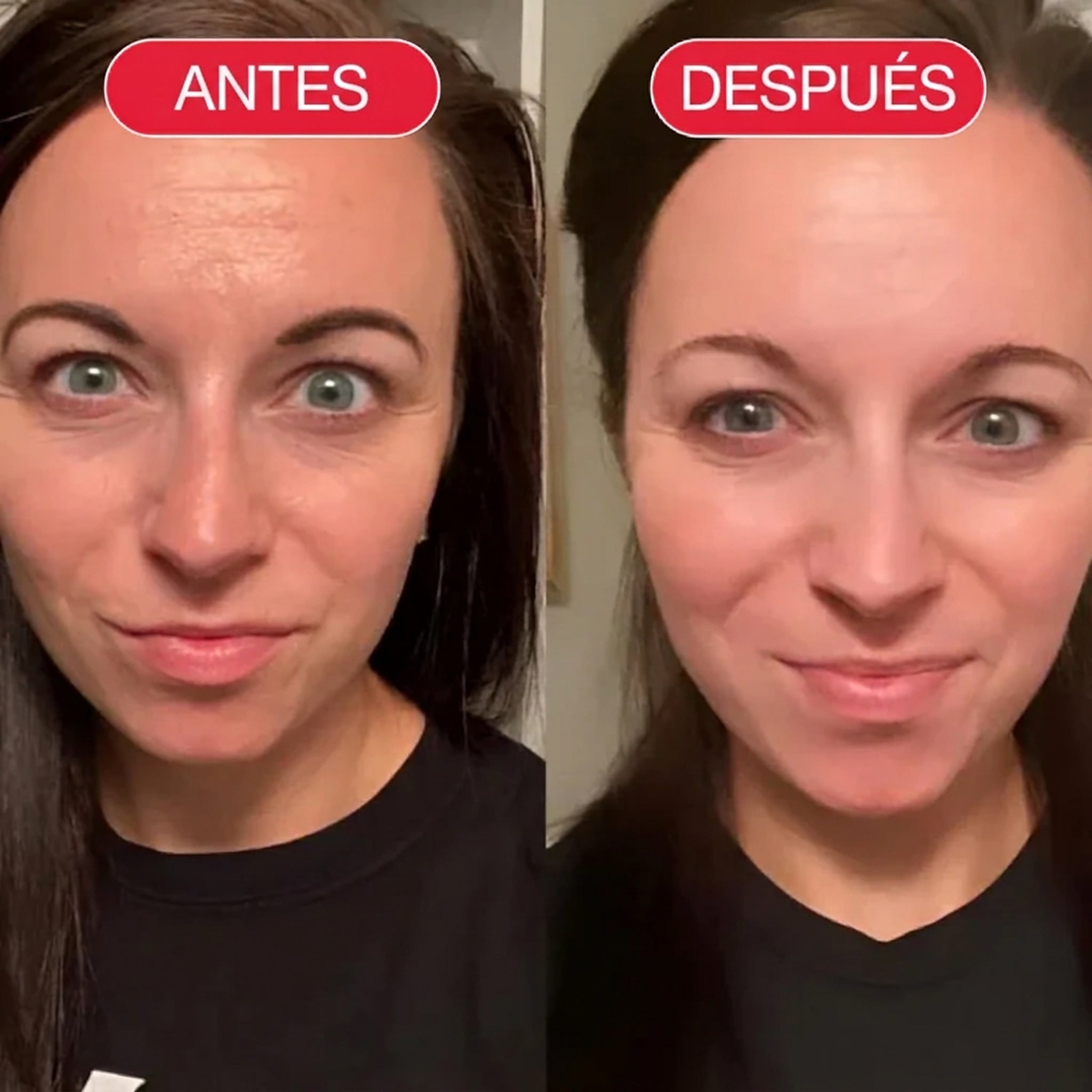 Antes y después de usar Nutripiel